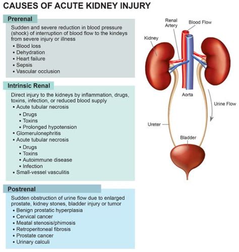 Acute Kidney Injury in Patients With Cancer