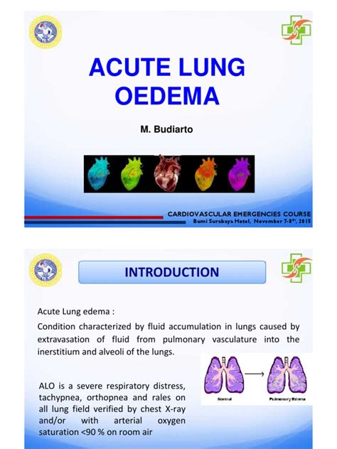 Acute Lung Edema R Mohammad Budiarto MD FIHA pdf