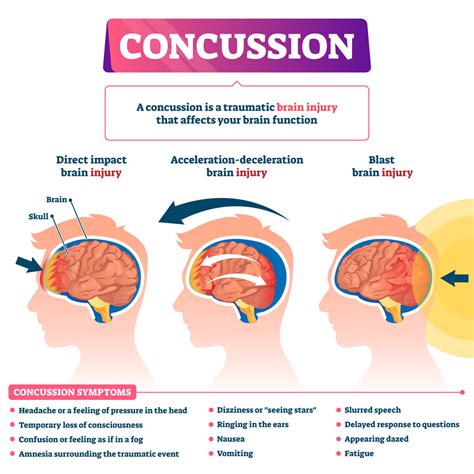 Acute Mild Traumatic Brain Injury Concussion in Adults UpToDate