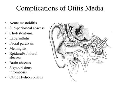 Acute Otitis Media With Intracranial and Intratemporal Complications