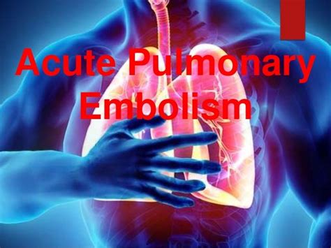 Acute Pulmonary Embolism ppt