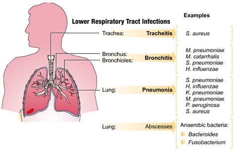 Acute Respiratory Infection and Pneumonia in India