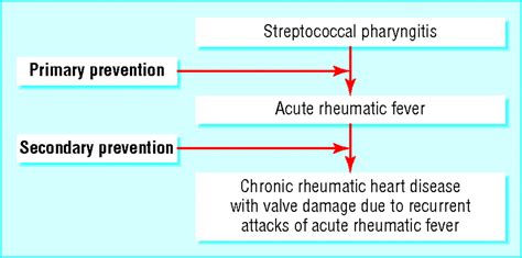 Acute Rheumatic Fever 2006