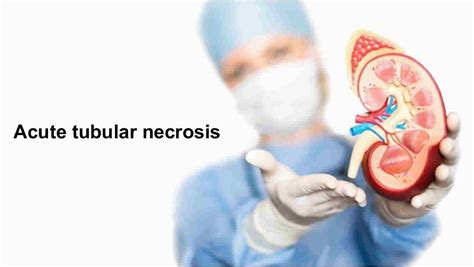 Acute Tubular Necrosis: Symptoms, Causes, Treatments …