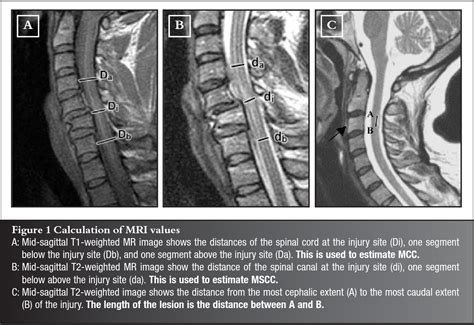 Acute cervical spine trauma in adults - Symptoms, diagnosis and