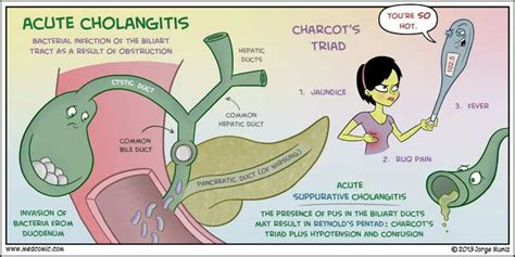 Acute suppurative cholangitis