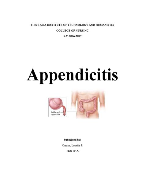 AcuteAppendicitis BSN 4A