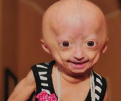 Adalia rose. Things To Know About Adalia rose. 