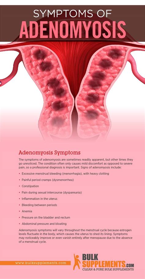 Adenomyosis cancer symptoms. .  <a href=https://empower-health-cms.cierr...