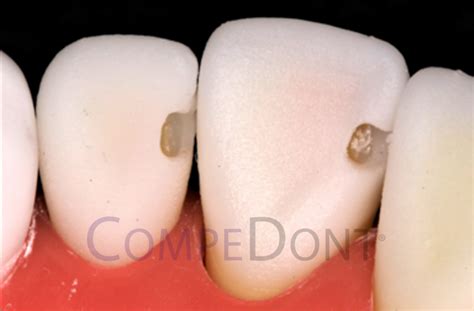 Adex compedont. .  Designed to address ethical and logistical concerns and imp...