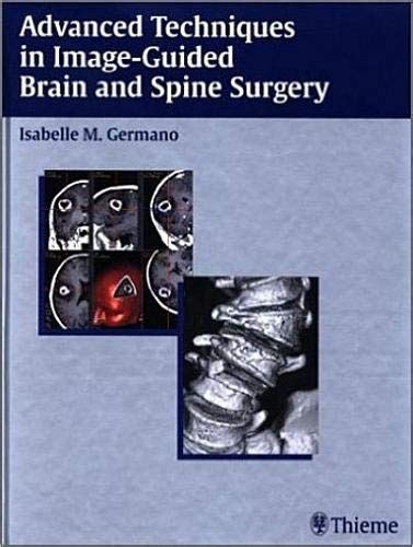 Advanced techniques in image guided brain and spine surgery. - Farmers weekly tractor guide new prices 2012.