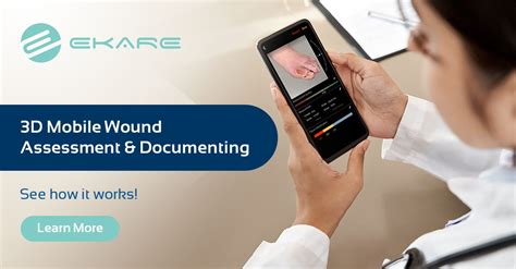 Advanced wound imaging Wound Measurement App ekare Inc.