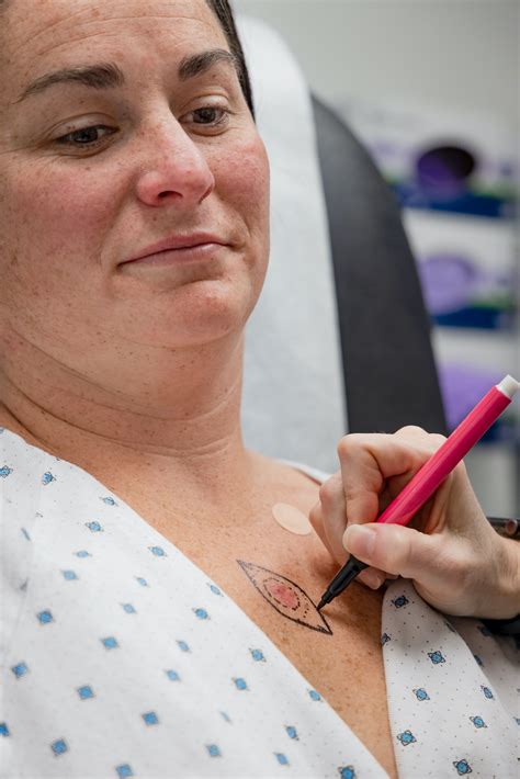 Advances in surgery are improving survival for people with melanoma