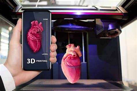 Advantages of 3D Printing in the Field of Medicine.