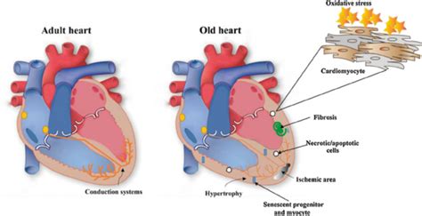 Aging Heart Changes Shape, Shrinks And Loses …