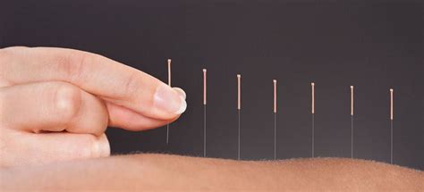 Akupunktur eğitimi istanbul