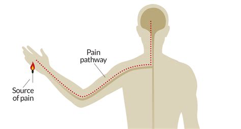 Alabama to Beijing… and Back: The Search for a Pain Gene