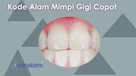 Alam gigi atas copot togel. Mimpi bertemu ayah yang sudah.