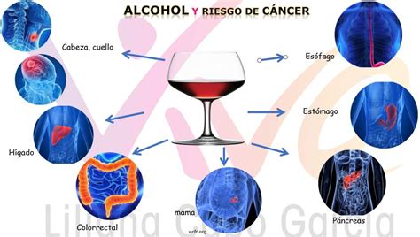 Alcochol y Cancer de Pecho REV pdf