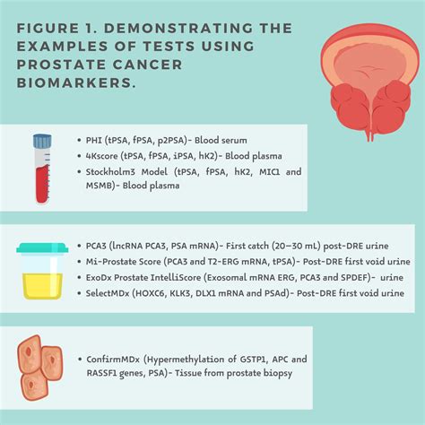 Alcohol consumption and PSA‐detected prostate cancer …