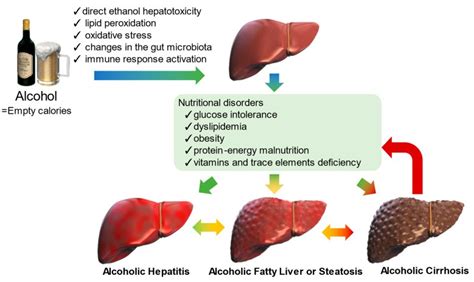 Alcoholic Steatohepatitis - Liver Patients International