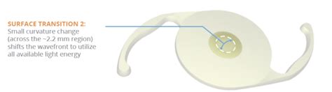 Alcon vivity iol specifications.  Contact a supplier or the parent company...