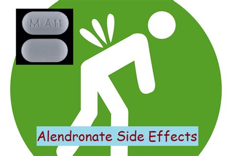 Alendronate Side Effects: Common, Severe, Long Term