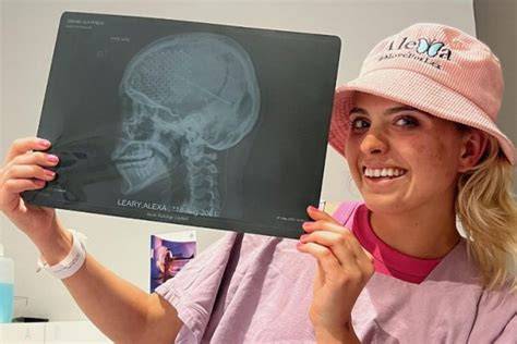 Alexa Leary Accident