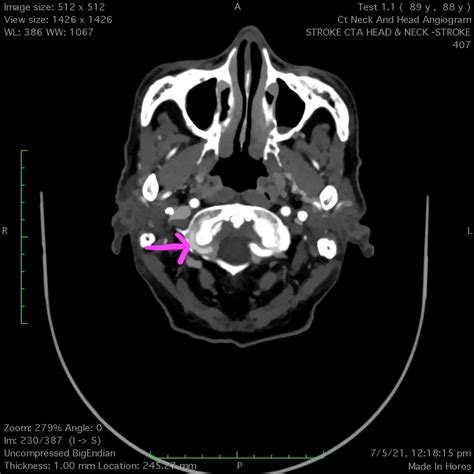 Alinakorolevajira Onlyfans Leak [HD] 🍆