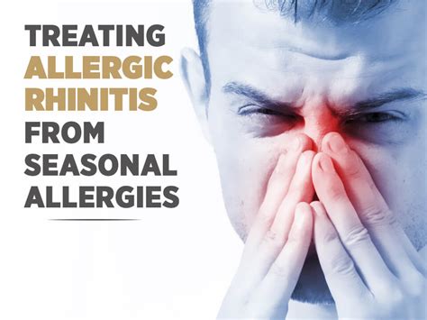 All About Allergic Rhinitis