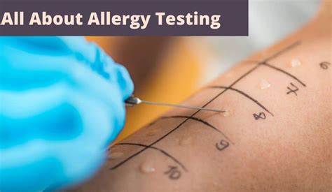 All About Allergy Testing Types, Benefits, and What to Expect