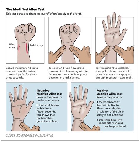 Allen Test
