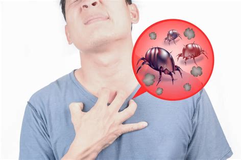 Allergie voor huisstofmijt - Huidarts.com