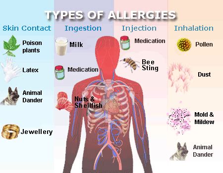 Allergy Fbs