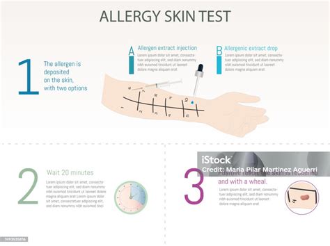 Allergy Skin Test Drop Or Intradermal Test And Process Stock