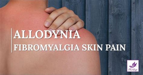 Allodynia: Fibromyalgia Skin Pain - Fibrodaze