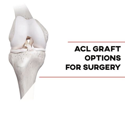 Allograft Acl 2012