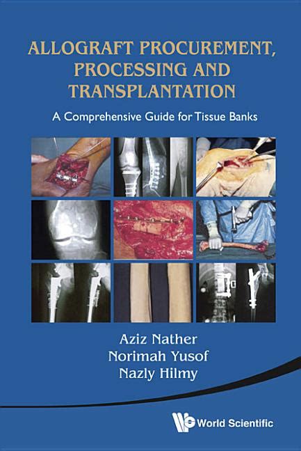 Allograft procurement processing and transplantation a comprehensive guide for tissue. - Ge undercounter ice maker repair manual.