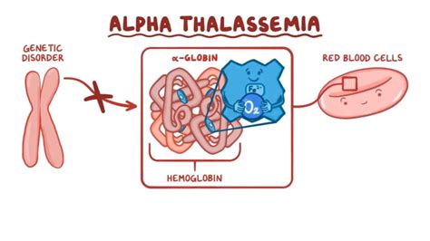 Alpha and Beta Thalassemia American Family Physician