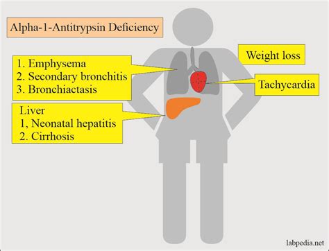 Alpha1-Antitrypsin (AAT) Deficiency Treatment & Management - Medscape