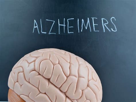 Alzheimer. Alzheimer’s disease, the most common dementia diagnosis among older adults. Alzheimer’s dementia is typically associated with abnormal buildups of proteins in the brain — known as amyloid plaques and tau tangles — along with a loss of connection among nerve cells. These changes can be seen during life using a PET scan. 