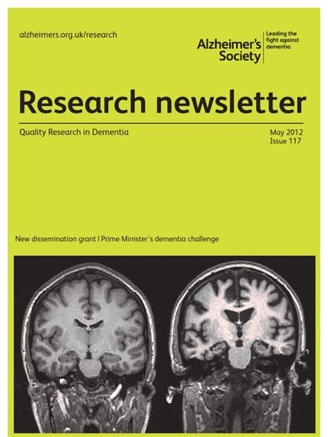 Alzheimers Research Newsletter May 2012