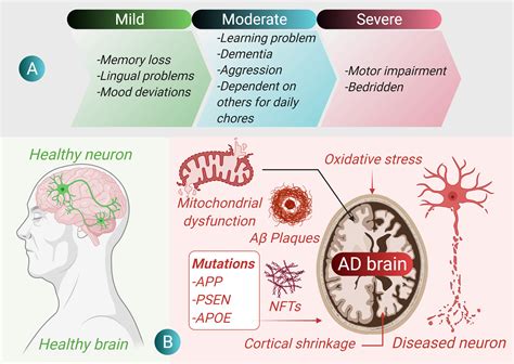 Alzheimers disease — Healint