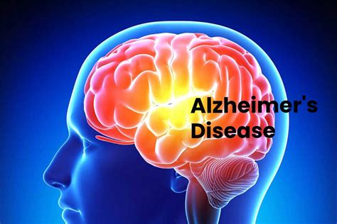 Alzhemers Disease