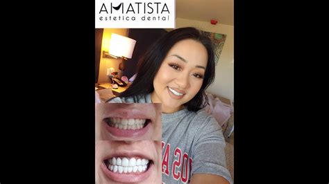 151 me gusta,Video de TikTok de Daniela Colmenares (@dani.colmenares7): «Mi sonrisa con los mejores @Amatista Estética Dental ️ #parati #destacame #viral».sonido original - ... 