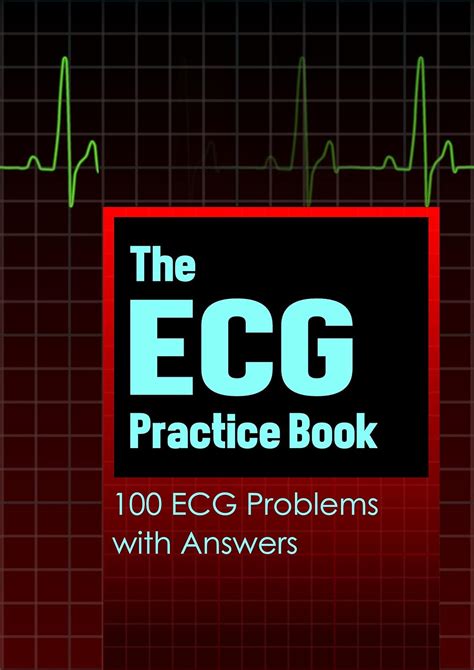 Amazon.com: Ekg For Dummies: Books