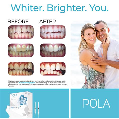 Amazon.com: Polanight Teeth Whitening