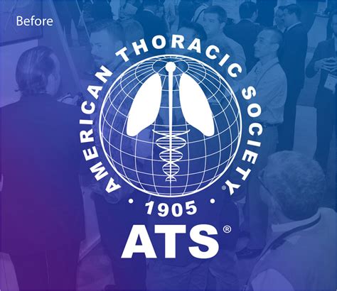 American Thoracic Society - CDC