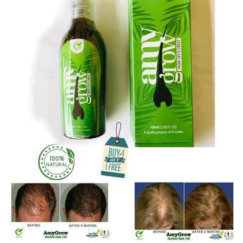 Amygrow. Jun 7, 2022 · Find many great new & used options and get the best deals for Amy Grow Best Hair Oil for Hair loss, Regrowth Fast Growing Herbal Men & Women at the best online prices at eBay! Free shipping for many products! 
