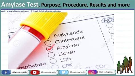 Amylase Test Procedure, Result And More Lab Tests Guide